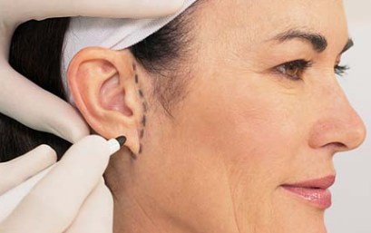 ear-surgery