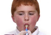 oral motor therapy