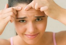 What is Comedonal Acne and How to Treat it